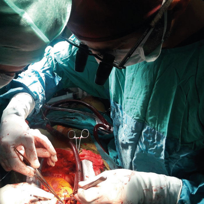 doktor-murat-tavlaşoğlu-ameliyat-2